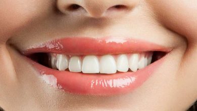 سفید کردن دندان ها در عرض سه سوت